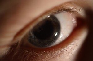 eye-300x199-3951397